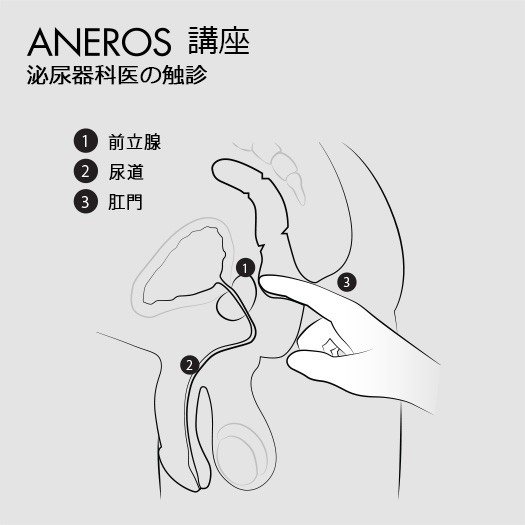 アネロス公式 前立腺の触診図(泌尿器科の触診)